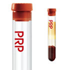 Platelet Rich Plasma PRP Tube 10ML 8ML 6ML With Anticoagulant ACD Gel Sodium Citrate & Gel